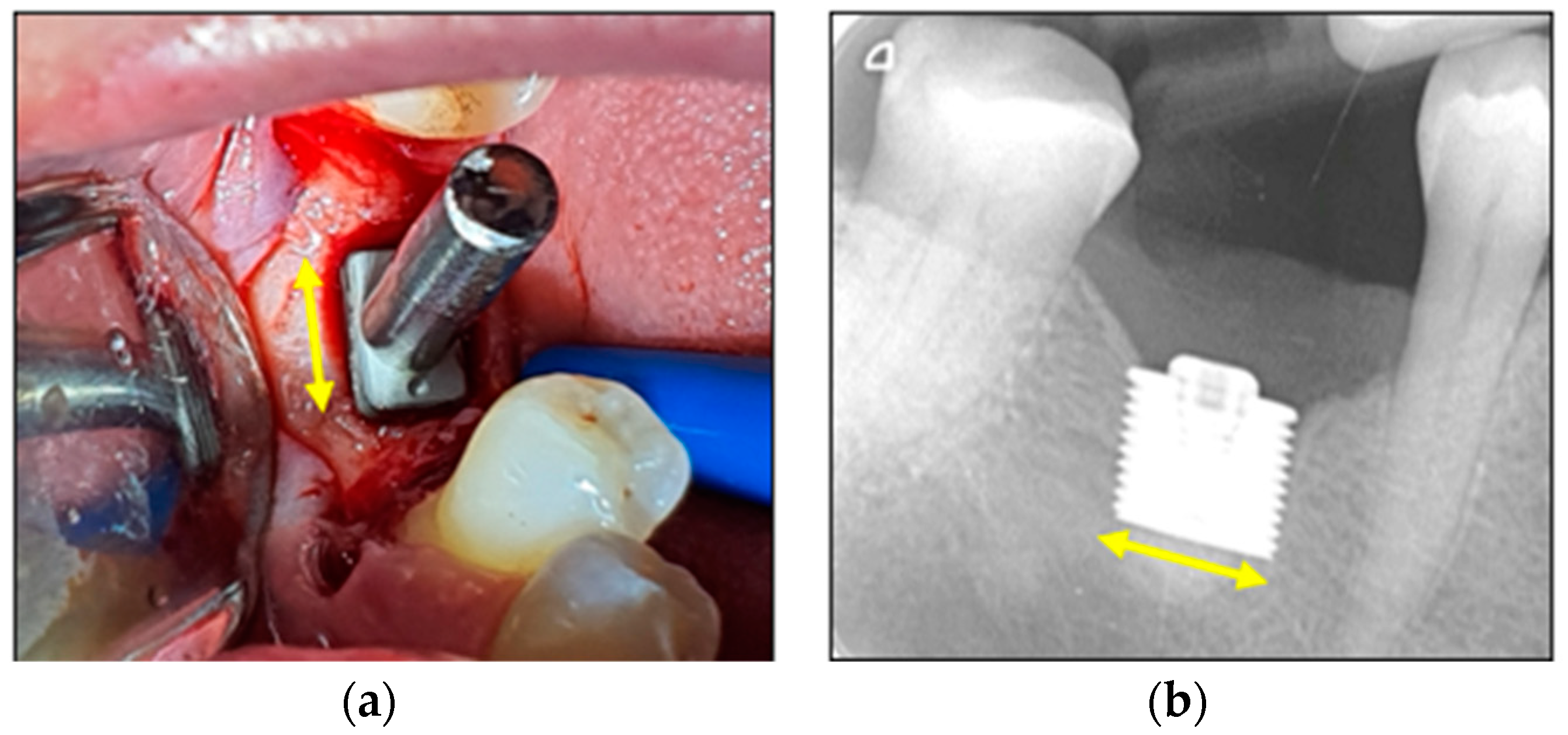 Bioengineering 11 00532 g012
