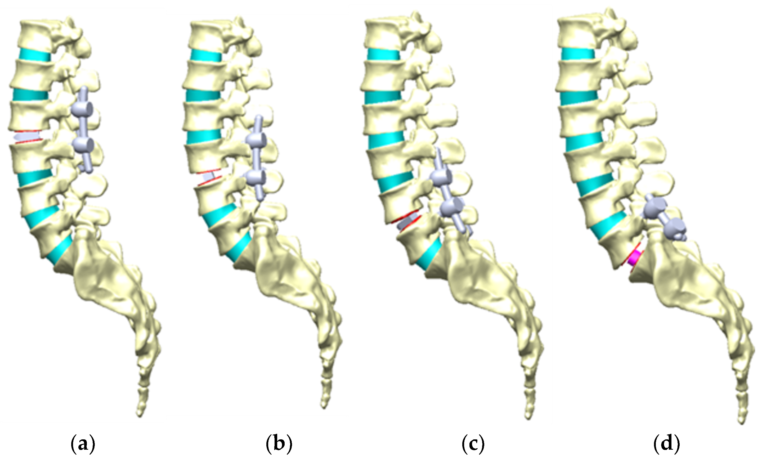 Bioengineering 11 00558 g007