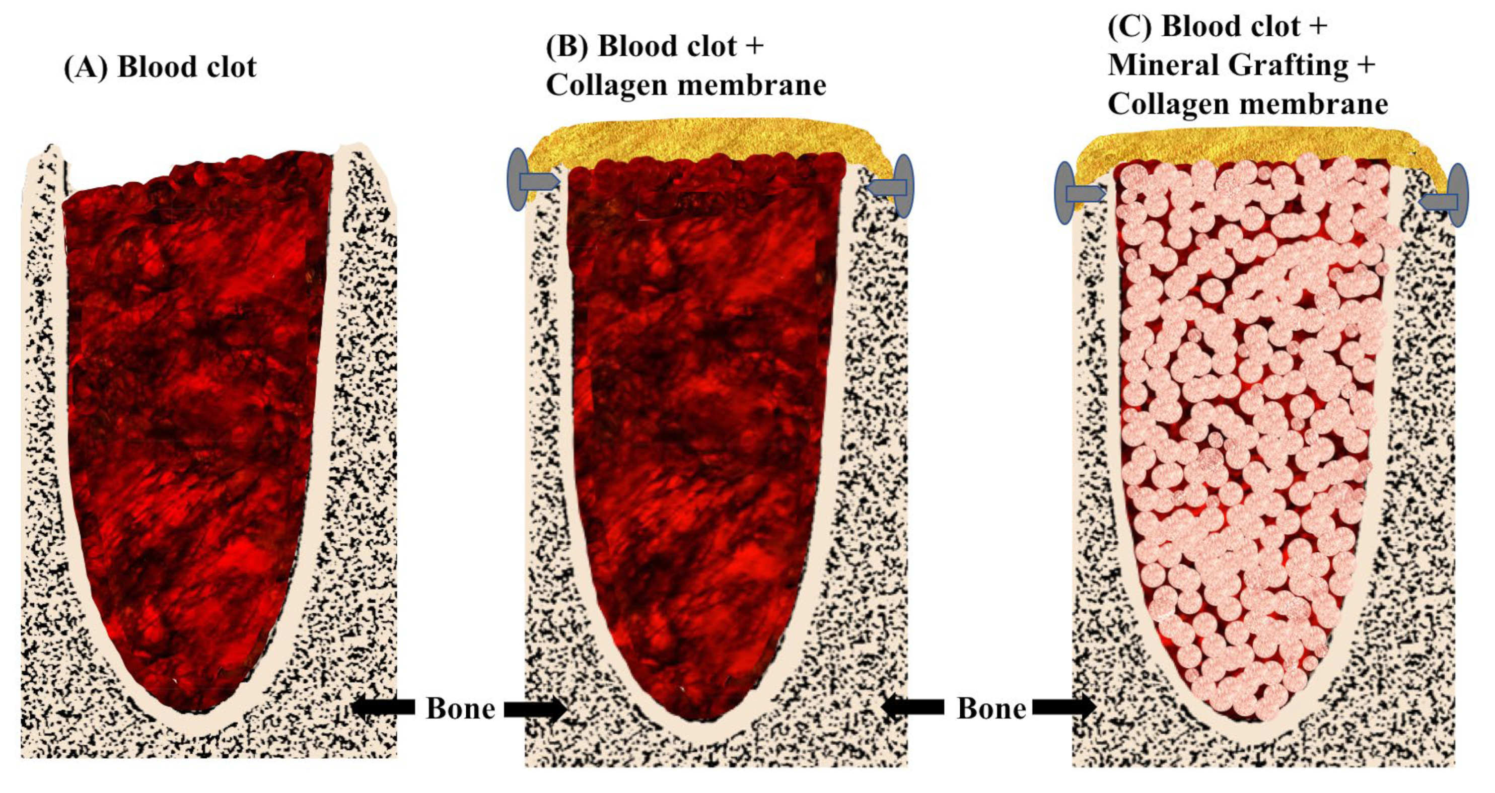 Bioengineering 11 00565 g001