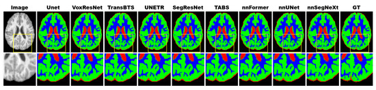 Bioengineering 11 00575 g0a6