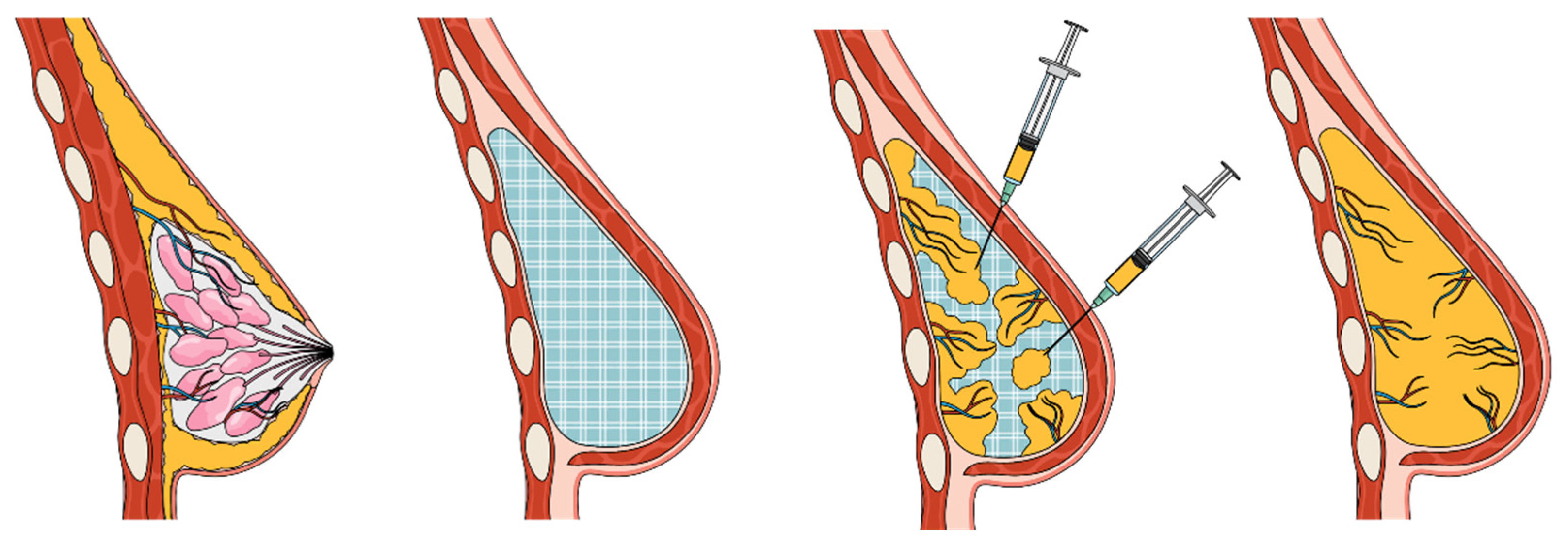 Bioengineering 11 00593 g001