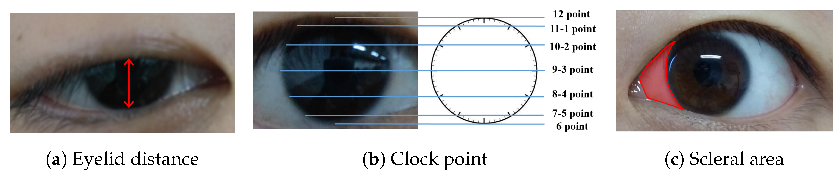Bioengineering 11 00595 g003