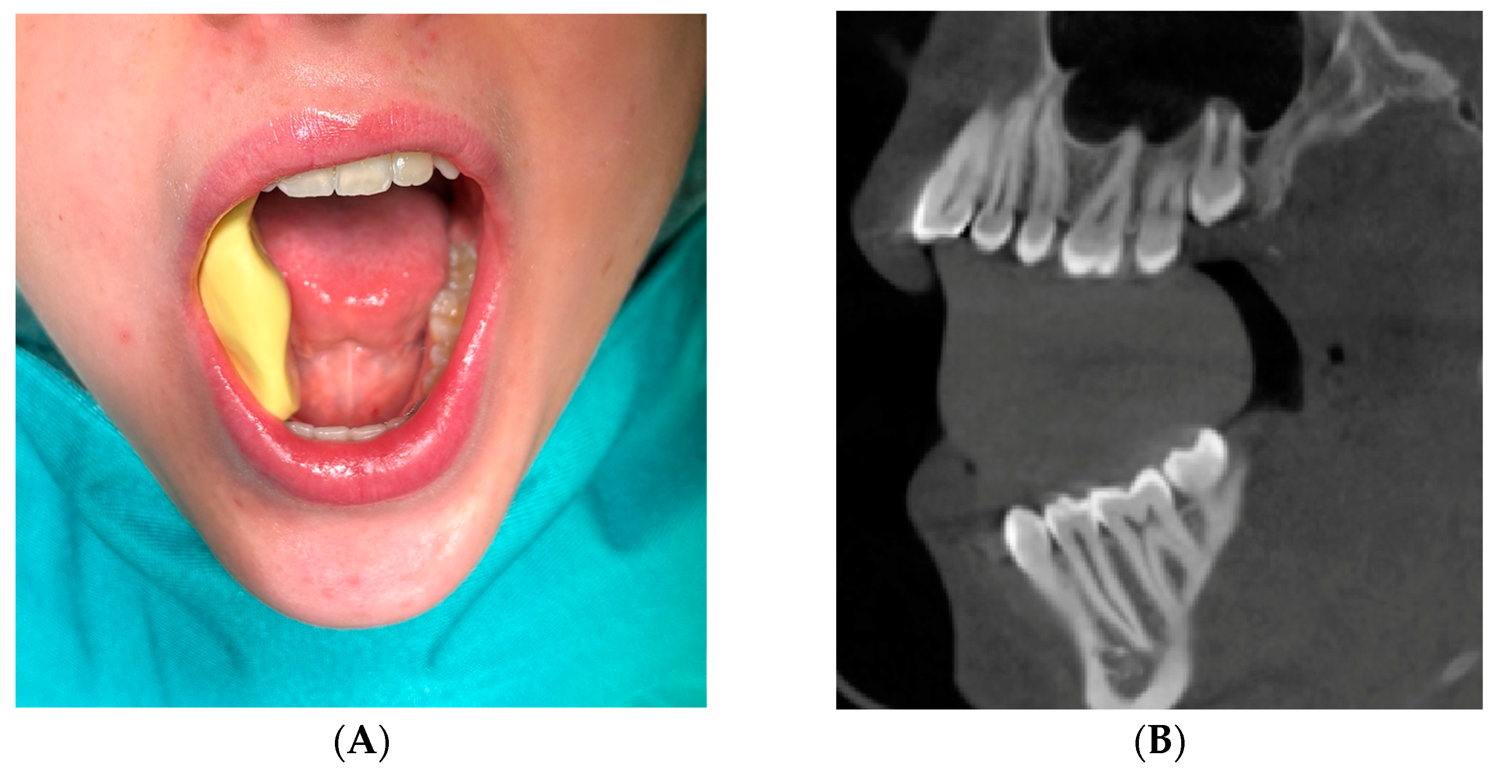 Bioengineering 11 00625 g003