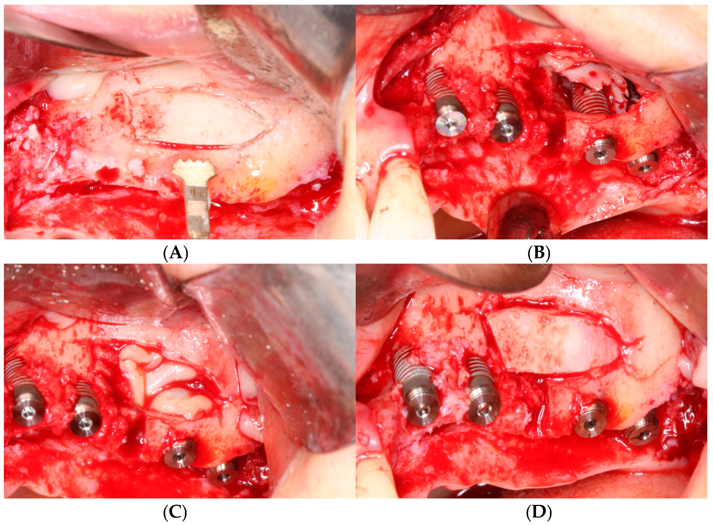 Bioengineering 11 00633 g005