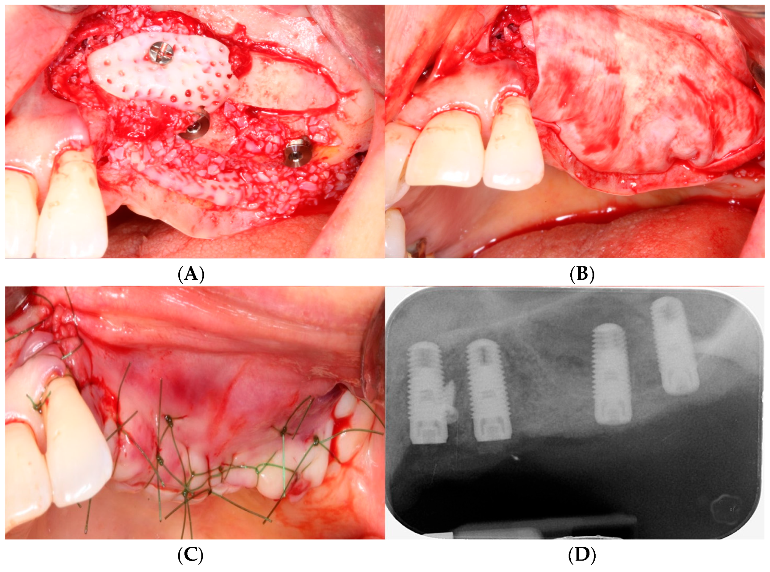 Bioengineering 11 00633 g006