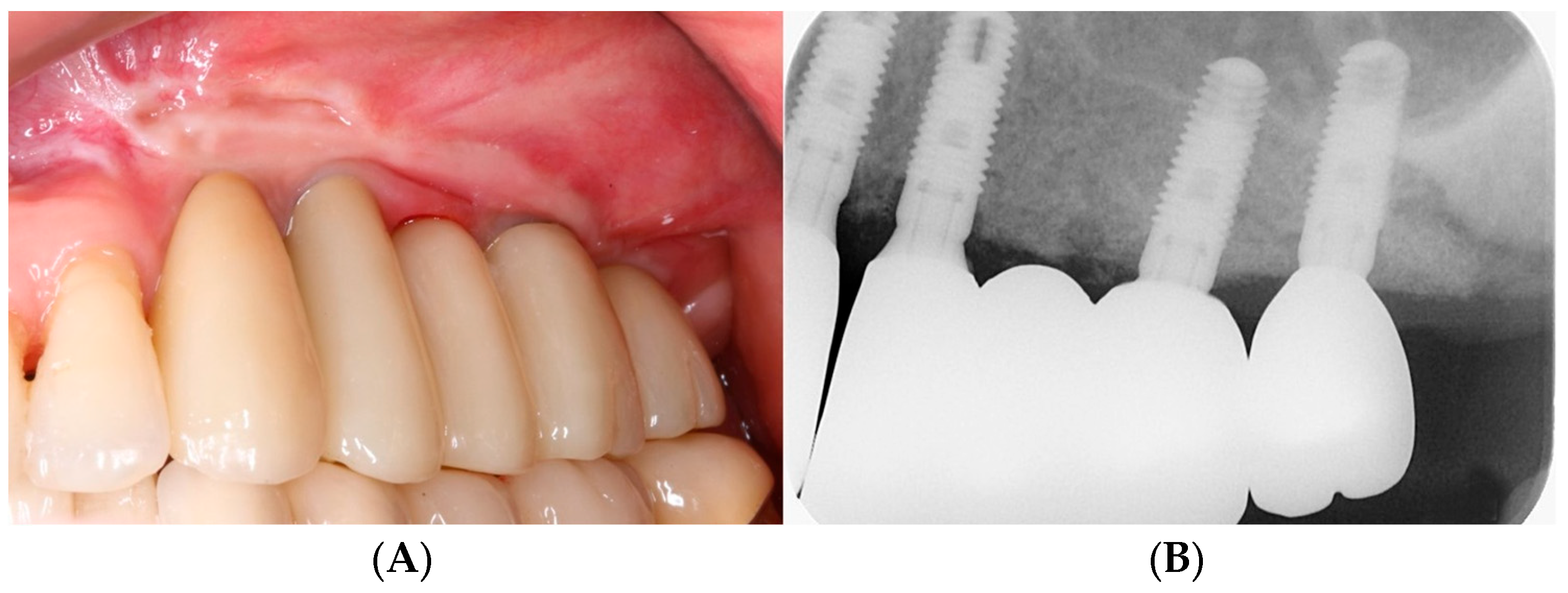 Bioengineering 11 00633 g009