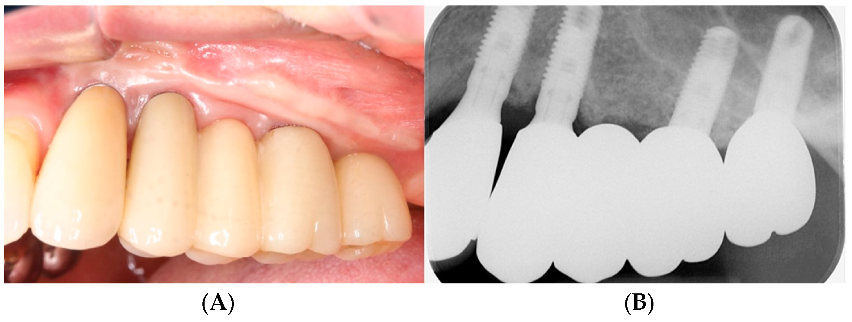 Bioengineering 11 00633 g010