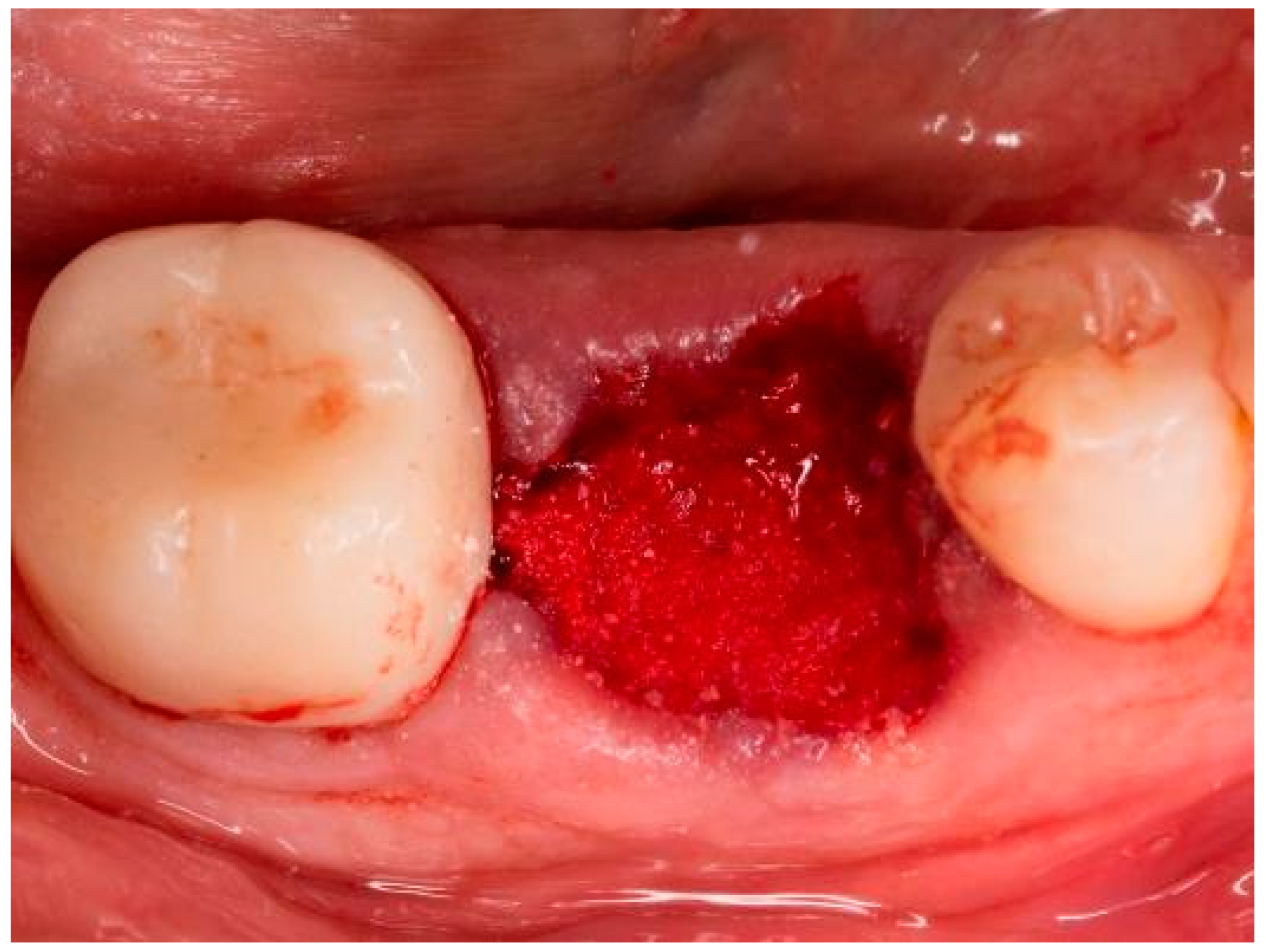 Bioengineering 11 00665 g003