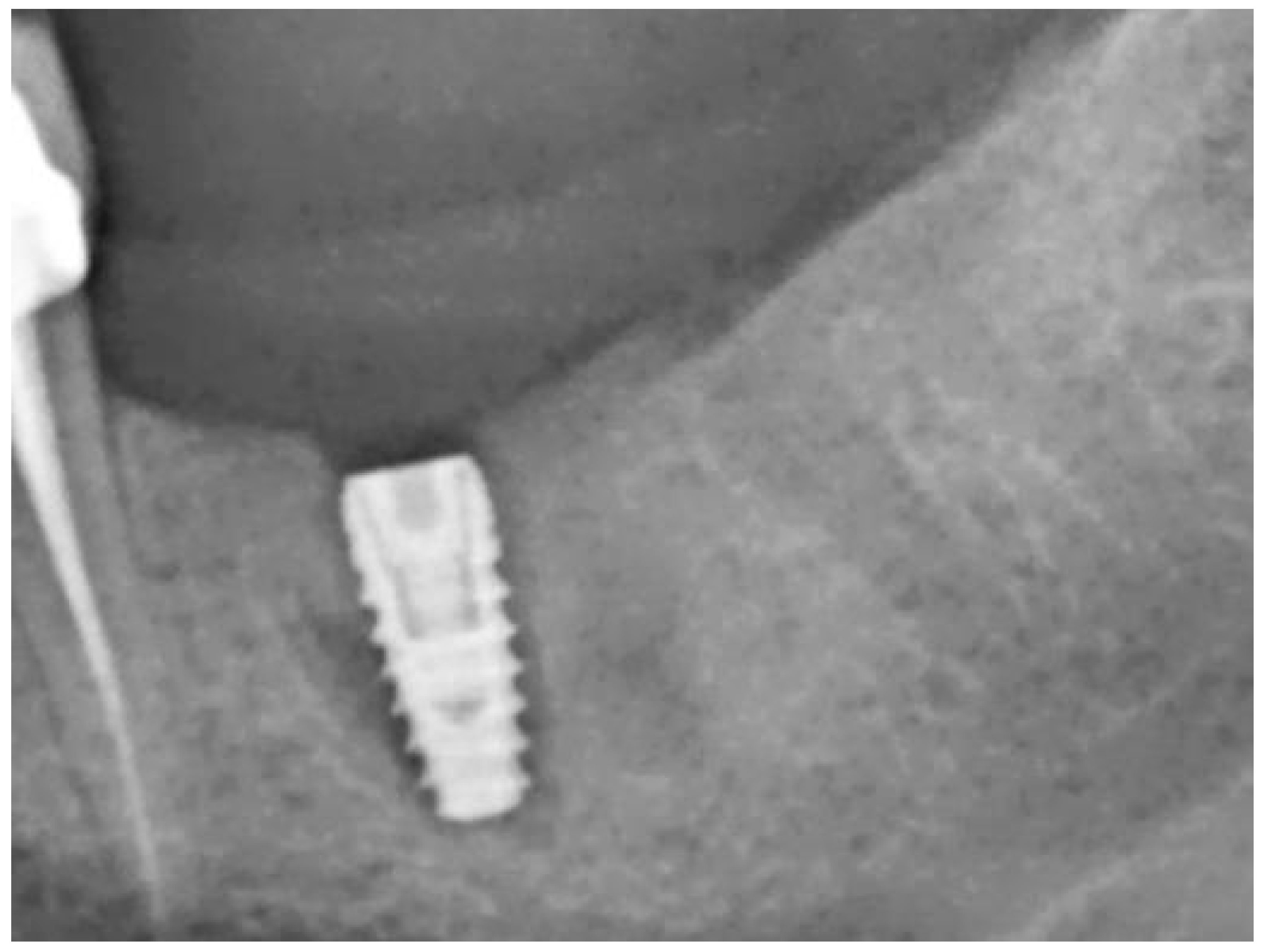 Bioengineering 11 00665 g006