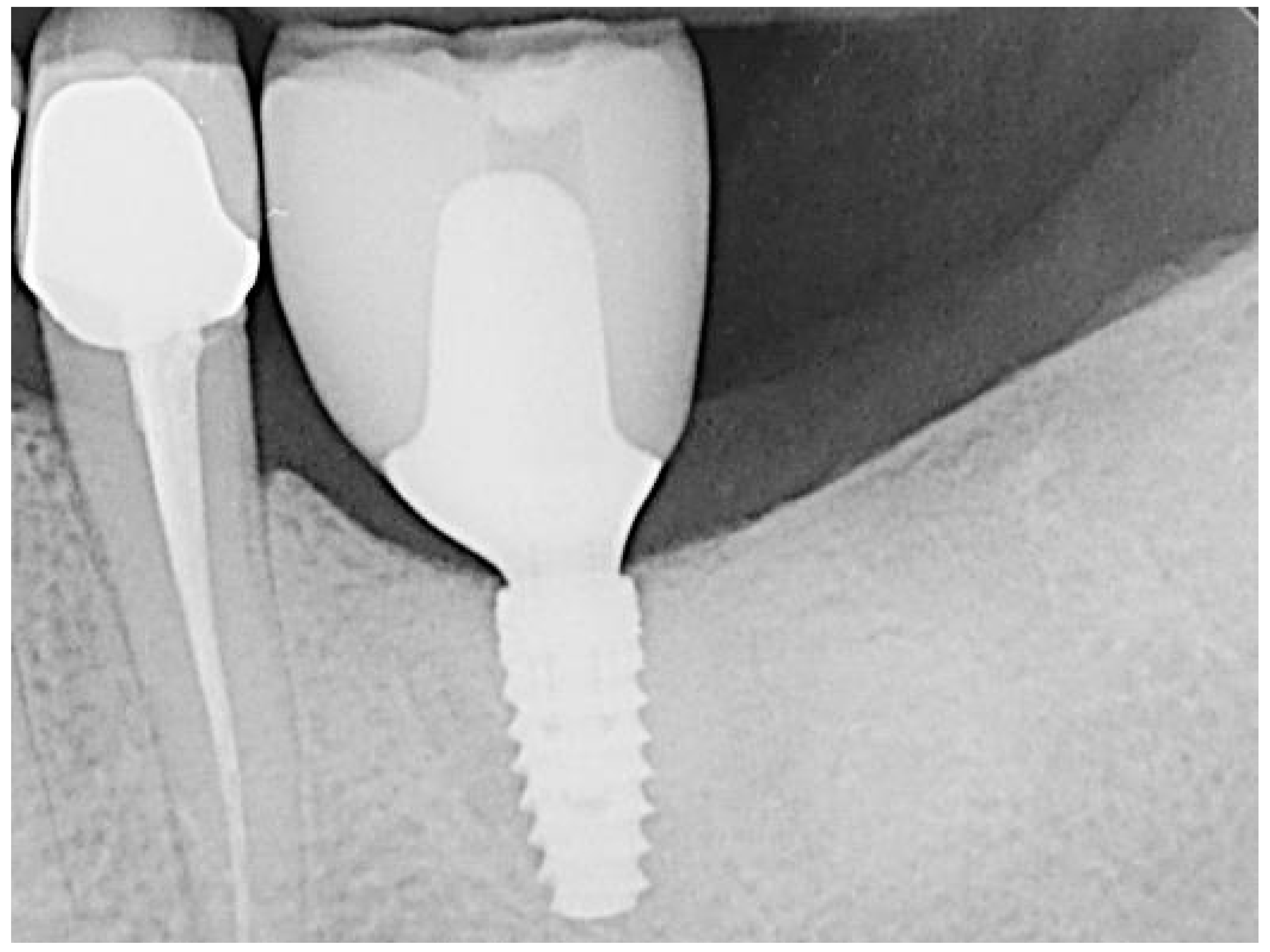 Bioengineering 11 00665 g007