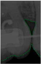 Bioengineering 11 00675 i007