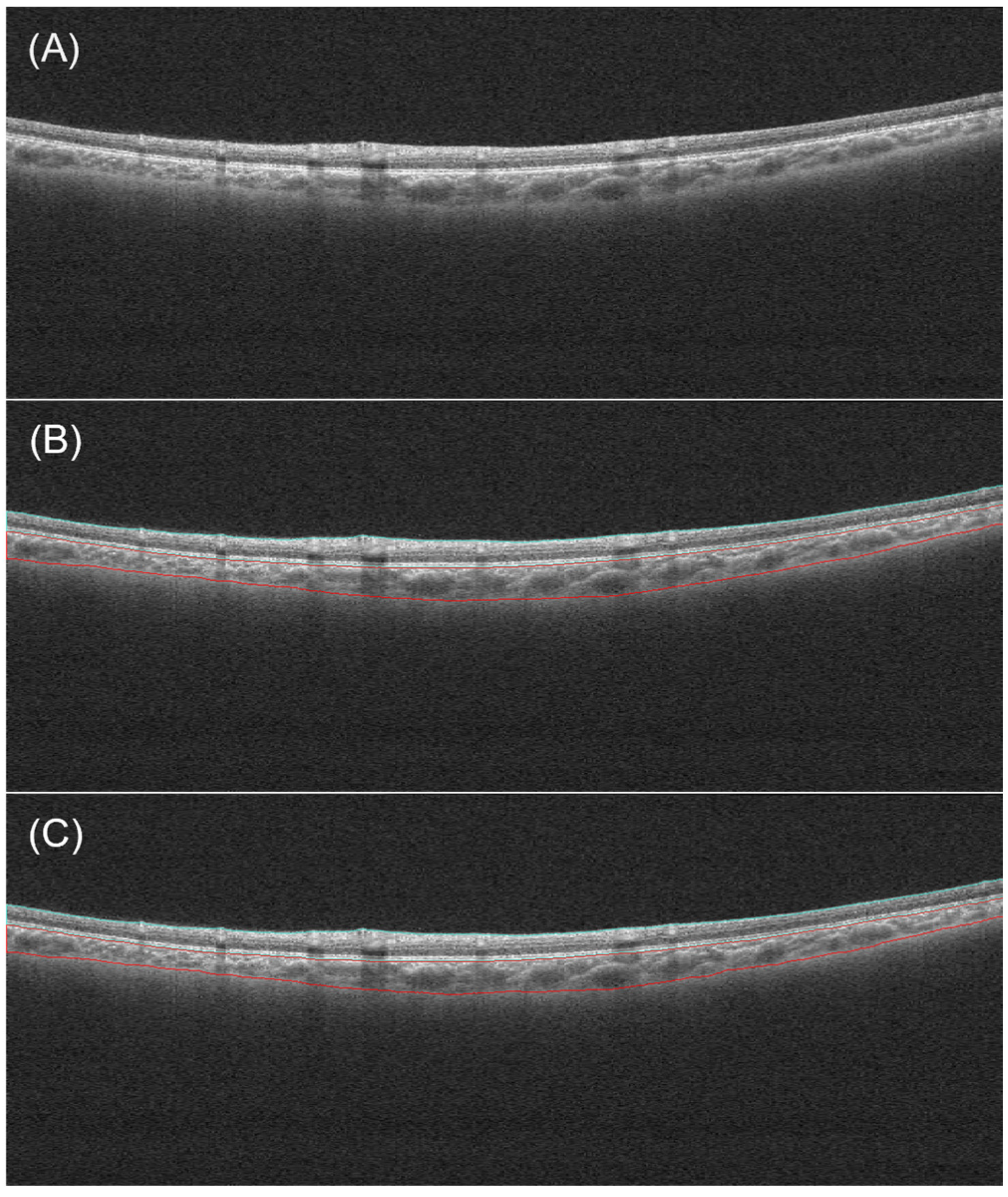 Bioengineering 11 00684 g004