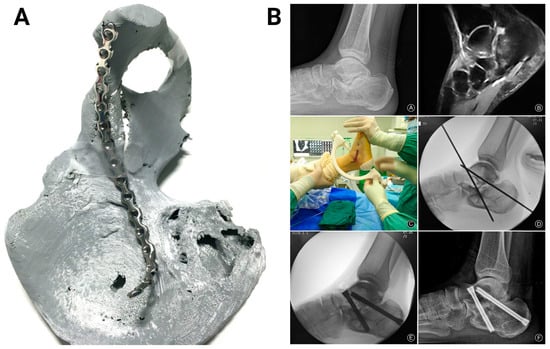 Bioengineering 11 00705 g005