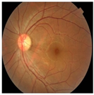 Bioengineering 11 00711 i001