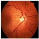 Bioengineering 11 00711 i003