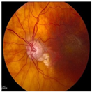 Bioengineering 11 00711 i005