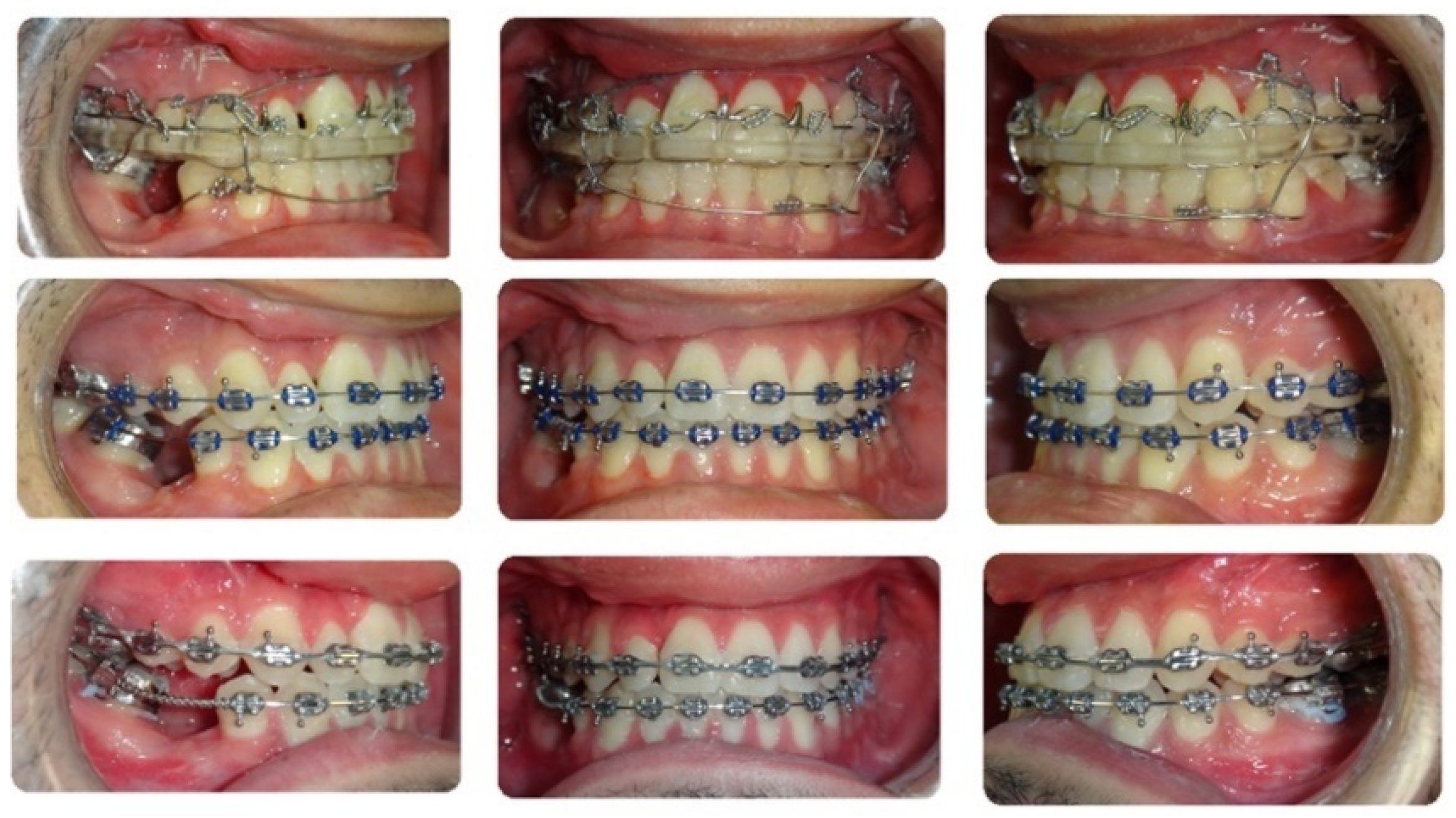 Bioengineering 11 00771 g008