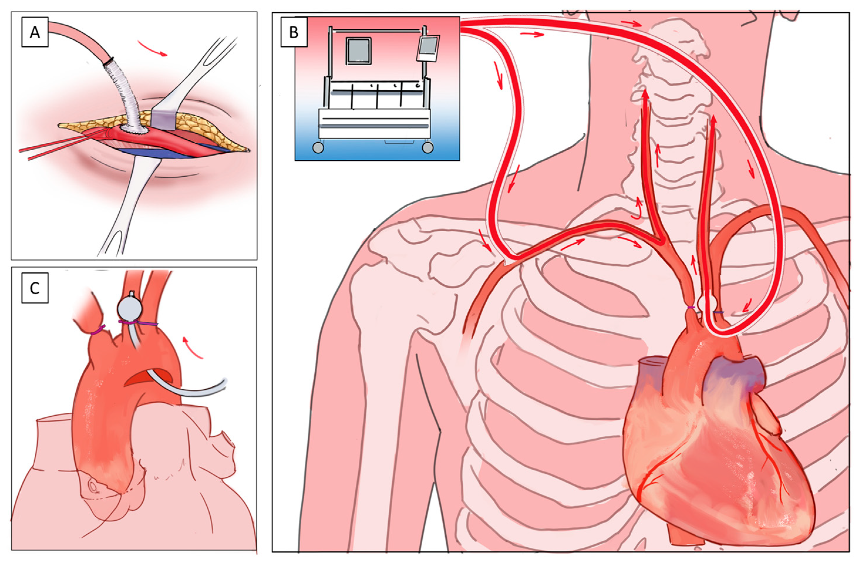 Bioengineering 11 00775 g001