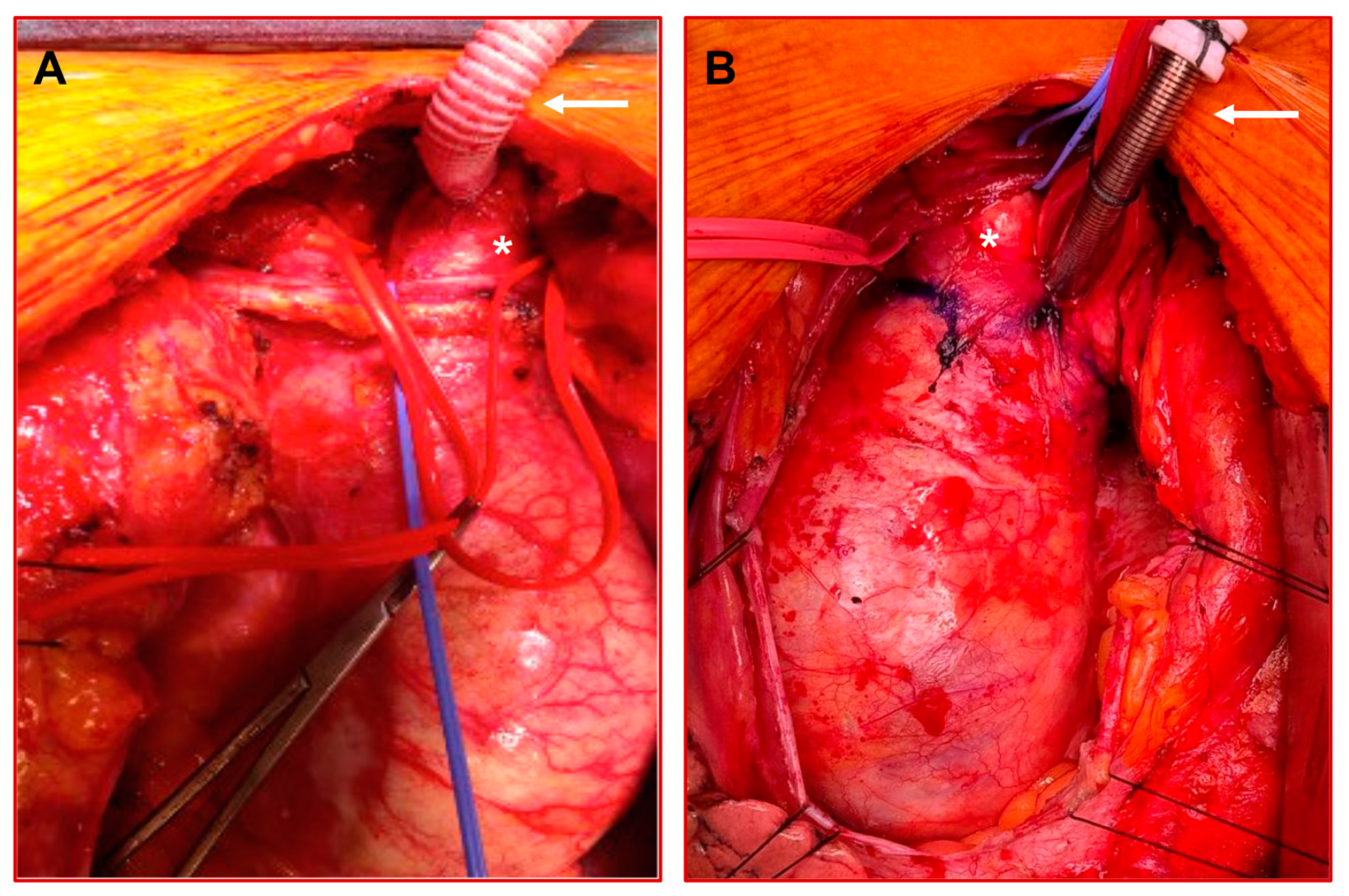 Bioengineering 11 00775 g002