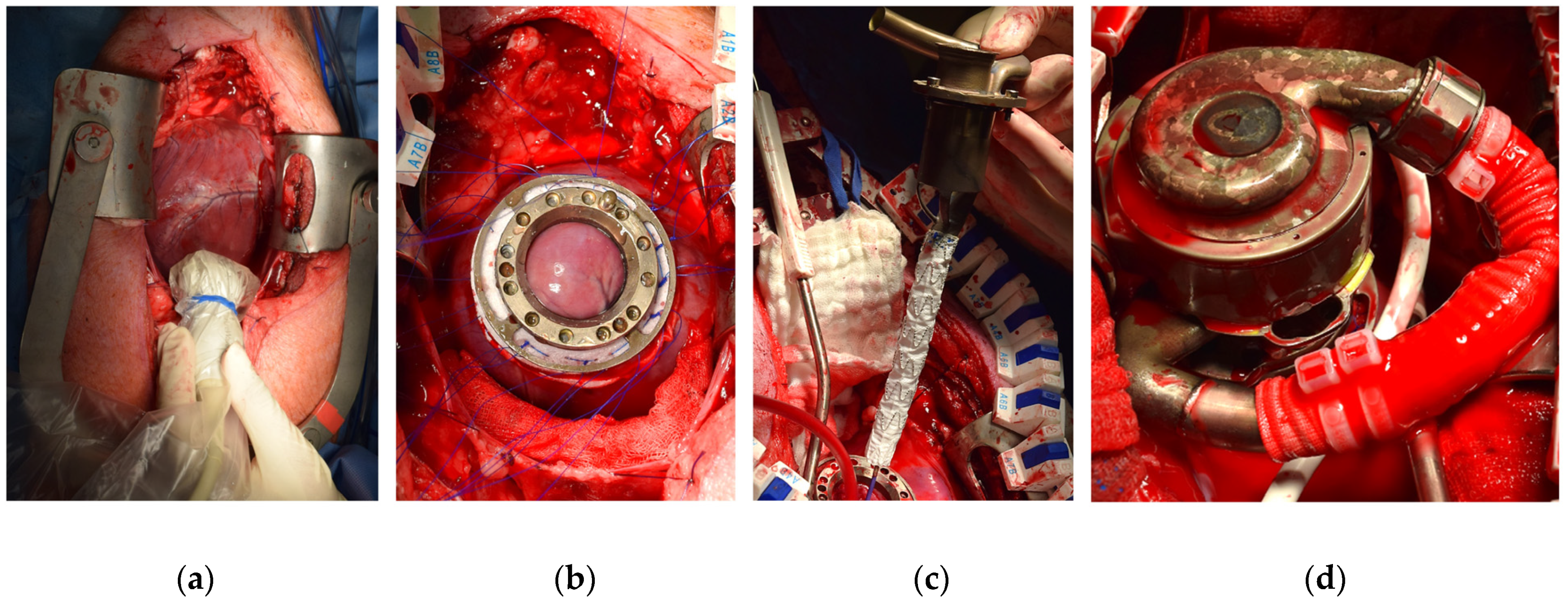 Bioengineering 11 00848 g003