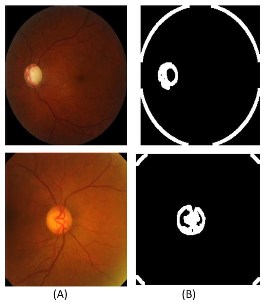 Bioengineering 11 00887 g003