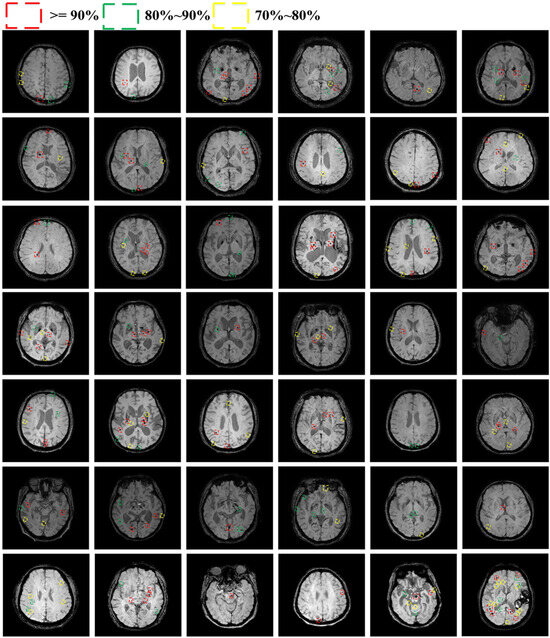 Bioengineering 11 00993 g0a1