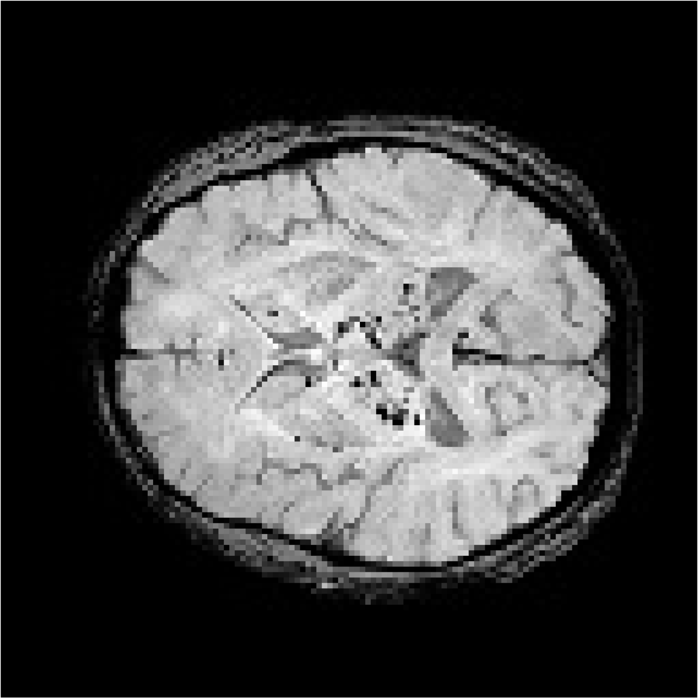 Bioengineering 11 00993 i004