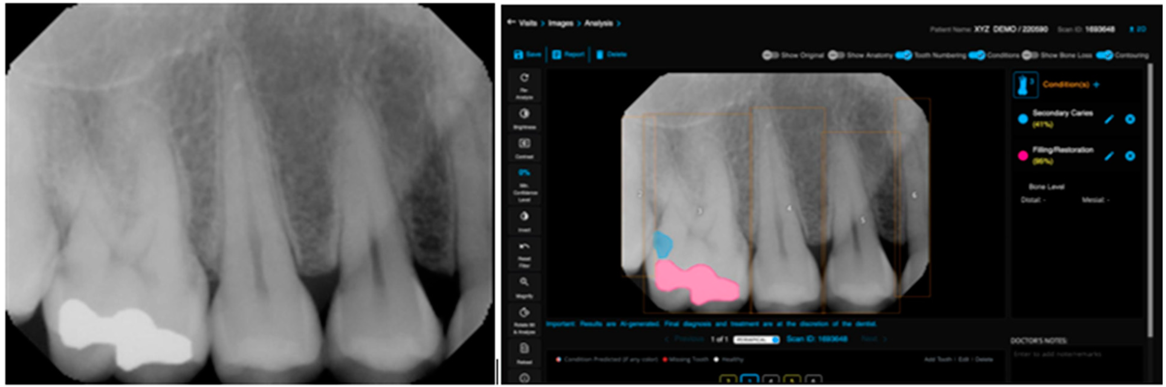 Bioengineering 11 01001 g002
