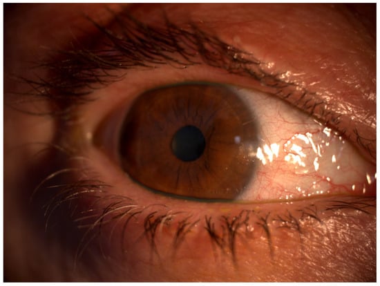 Bioengineering 11 01010 g003