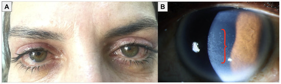 Bioengineering 11 01010 g004