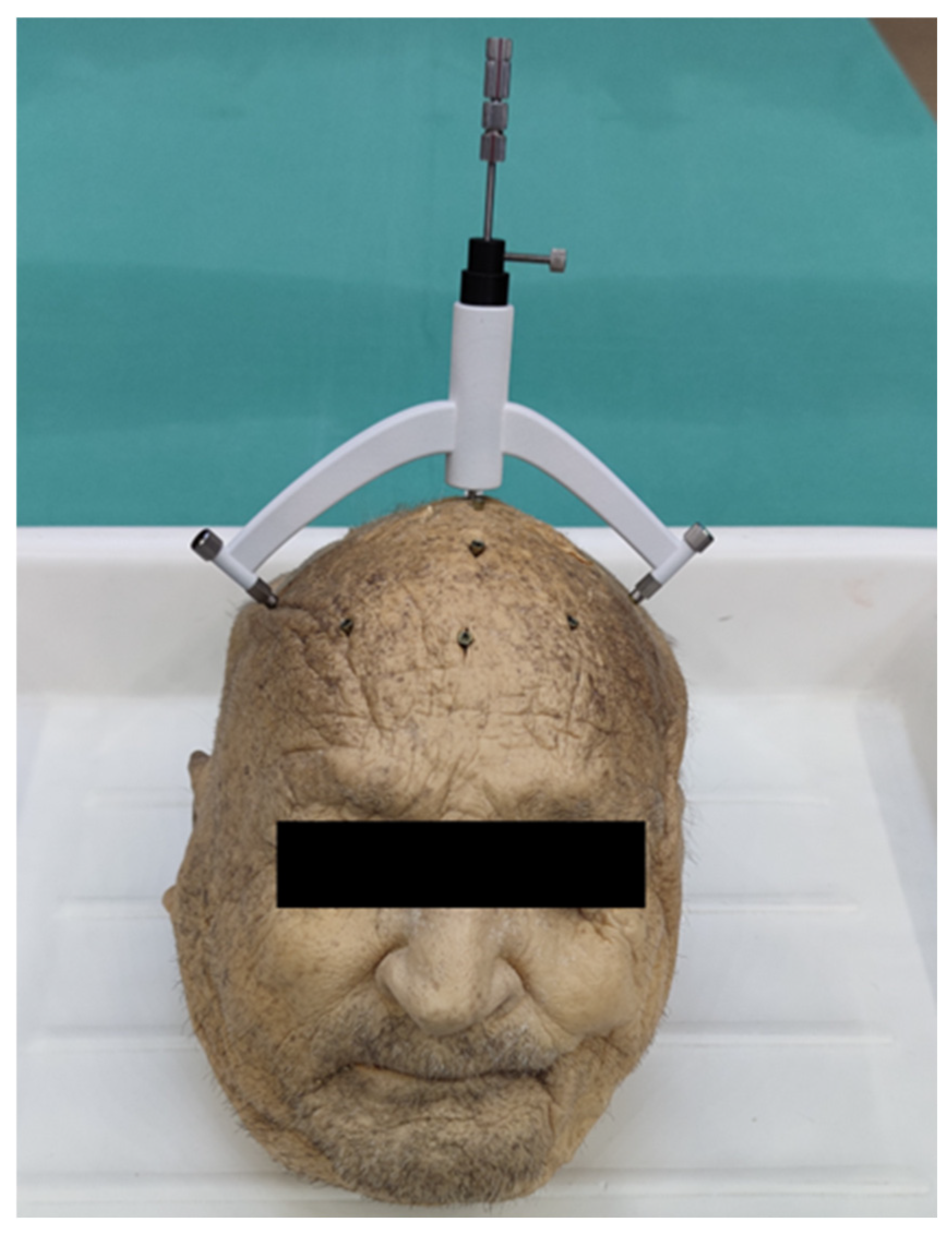 Bioengineering 11 01013 g004
