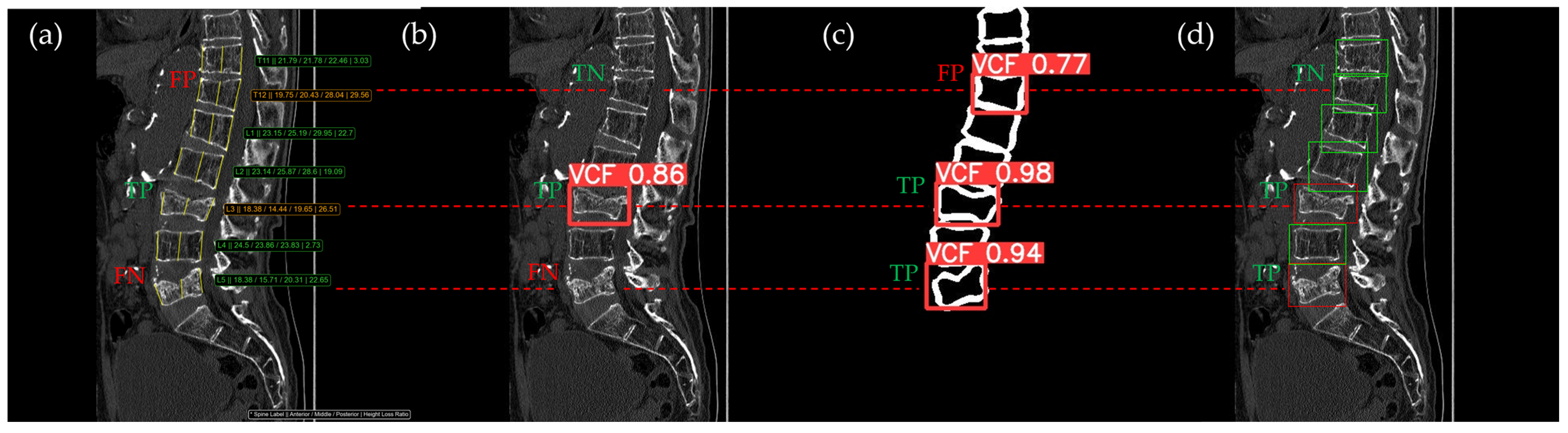Bioengineering 12 00064 g014