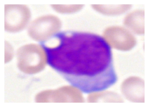 Bioengineering 12 00098 i006