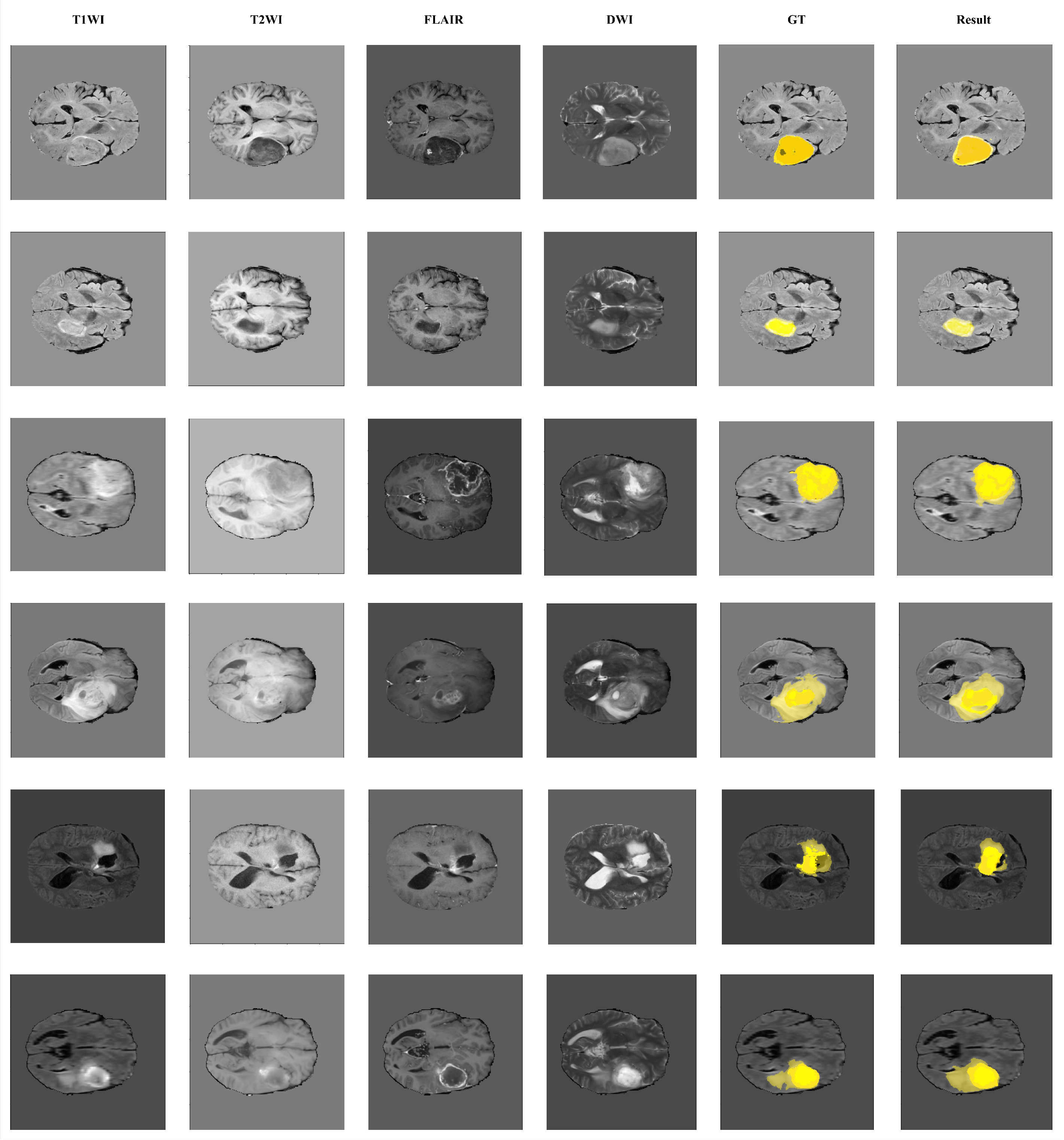 Bioengineering 12 00140 g003