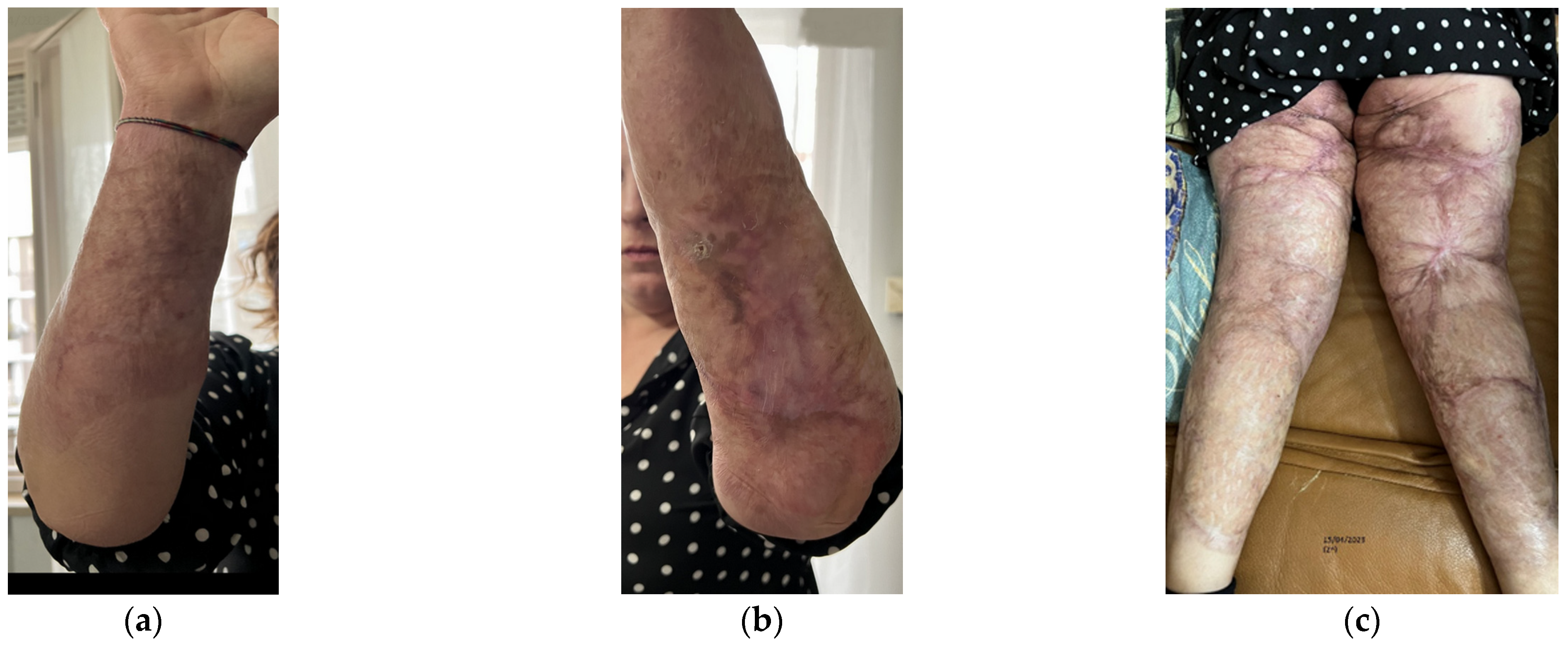 Bioengineering 12 00179 g001