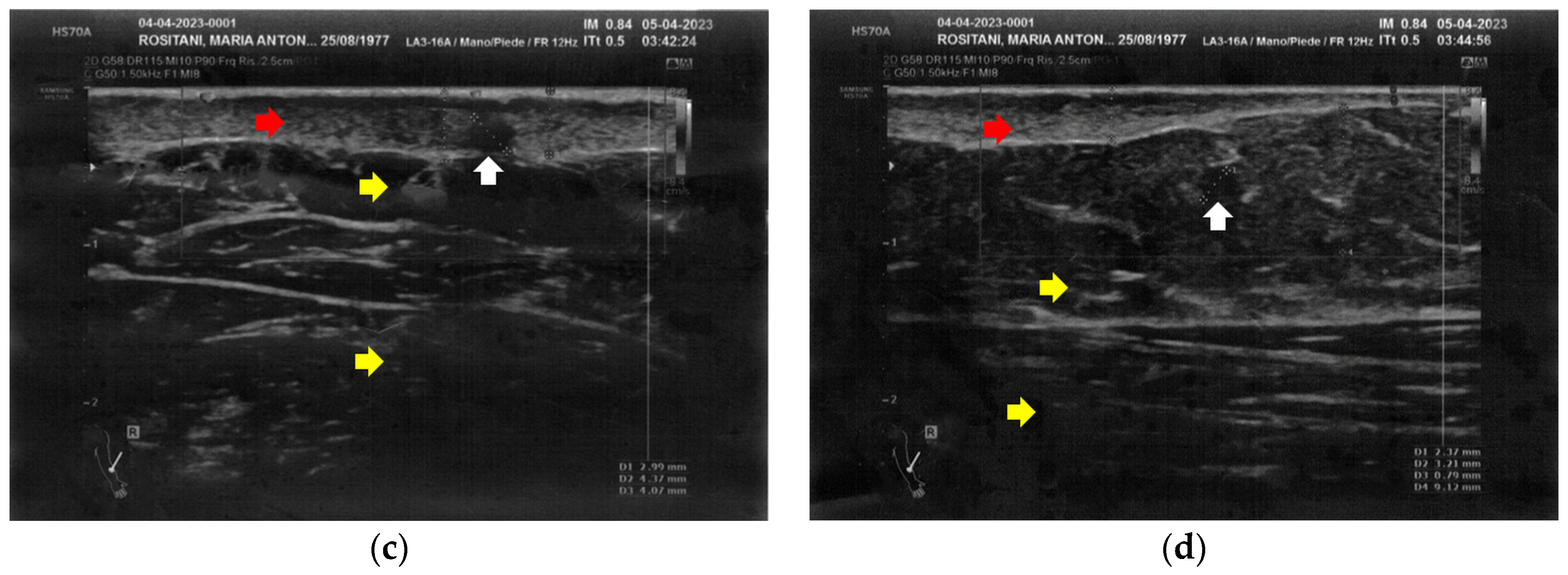 Bioengineering 12 00179 g002b