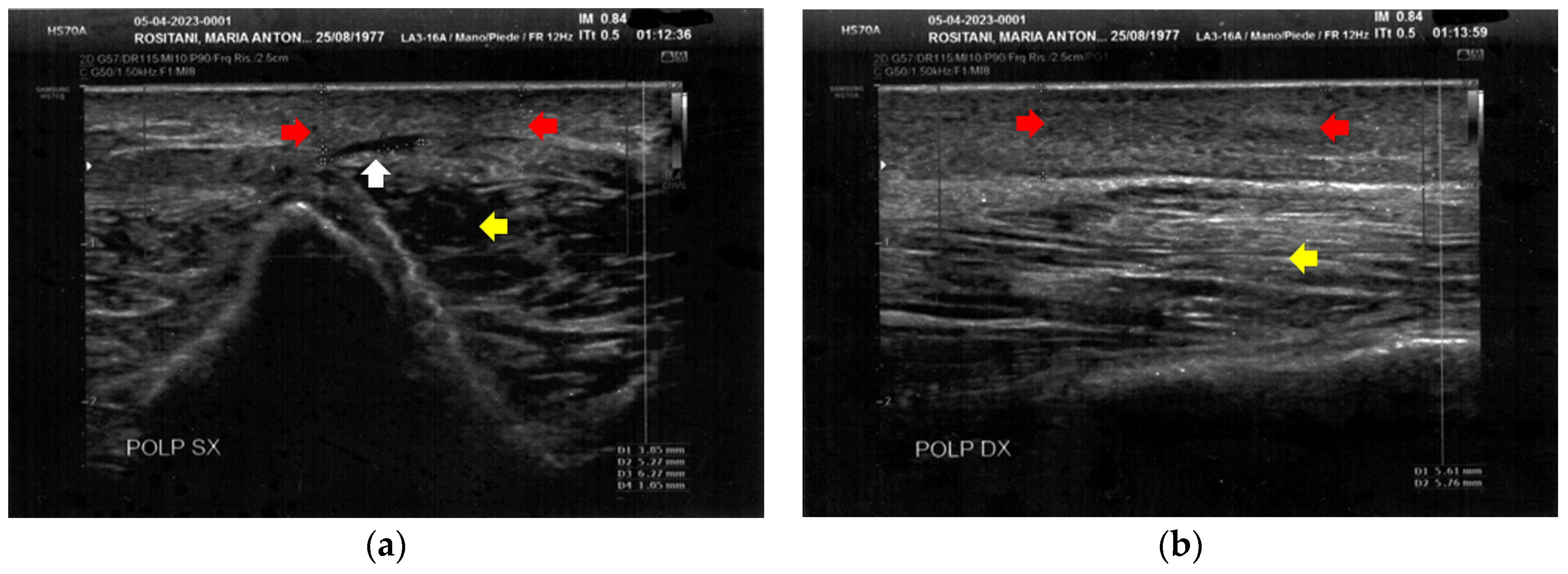 Bioengineering 12 00179 g004