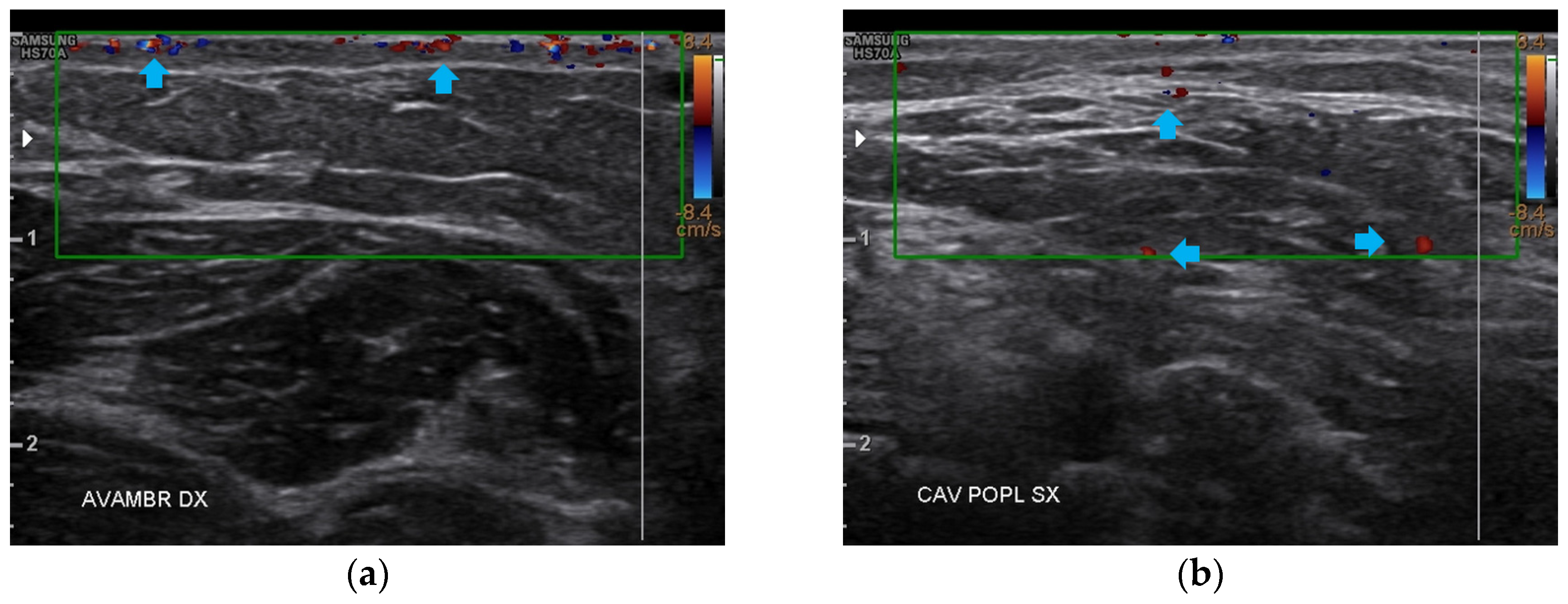 Bioengineering 12 00179 g010a