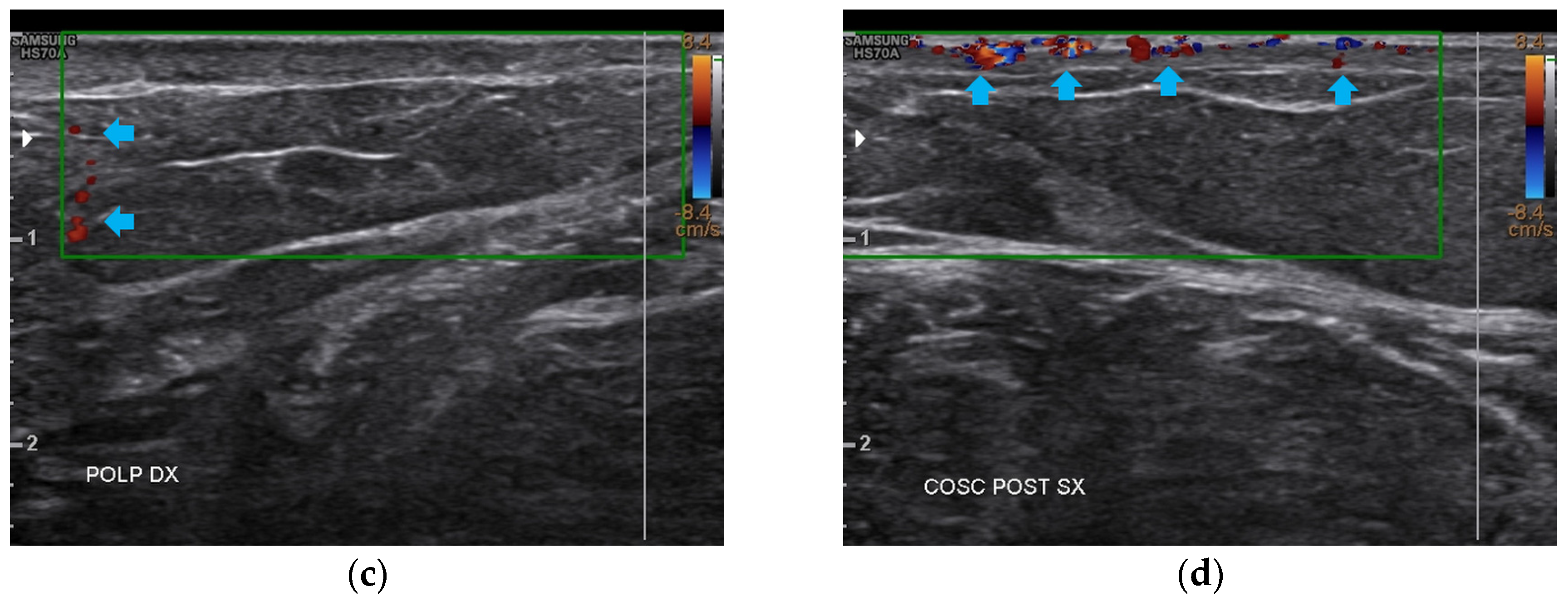 Bioengineering 12 00179 g010b