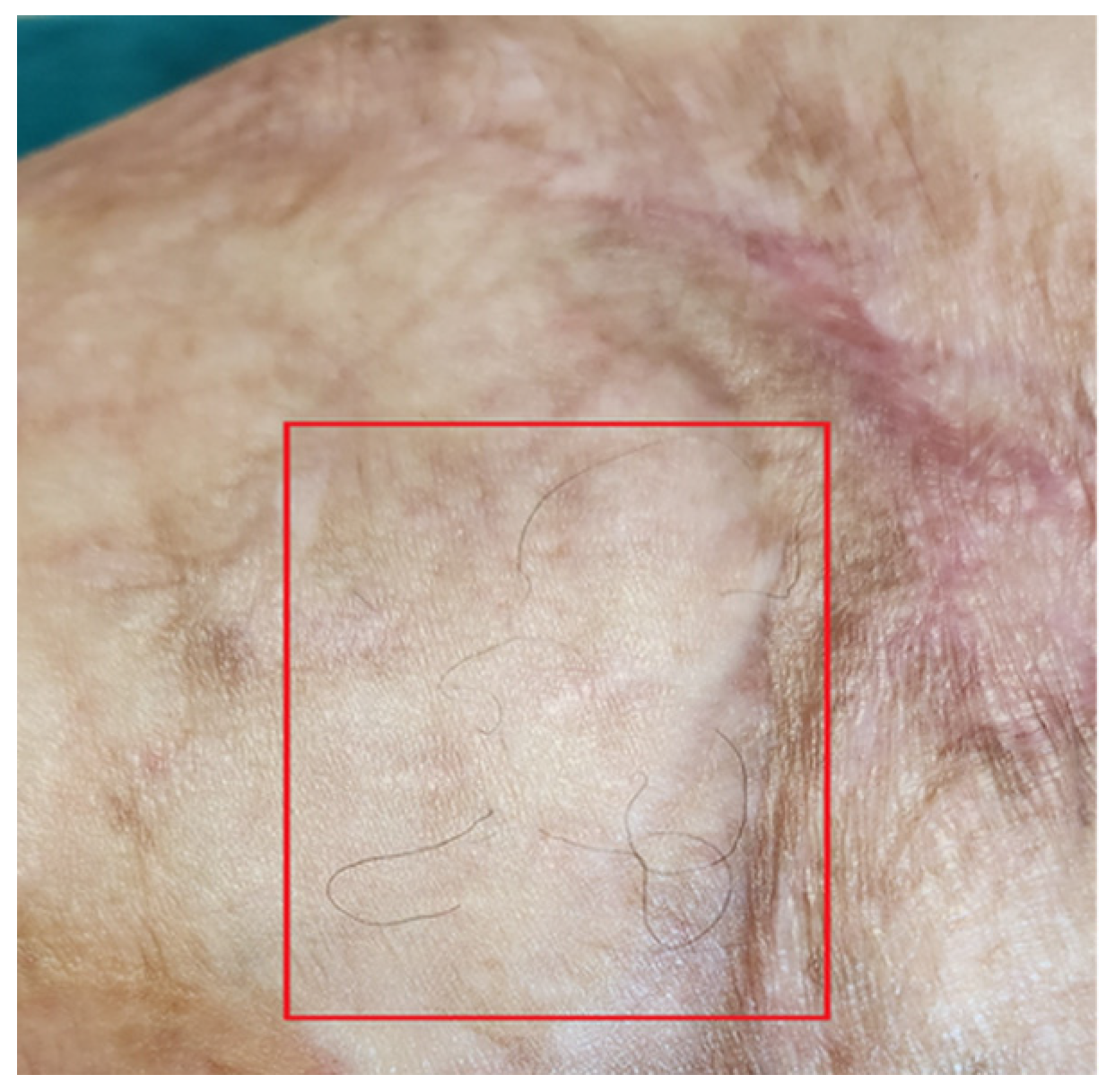 Bioengineering 12 00179 g014