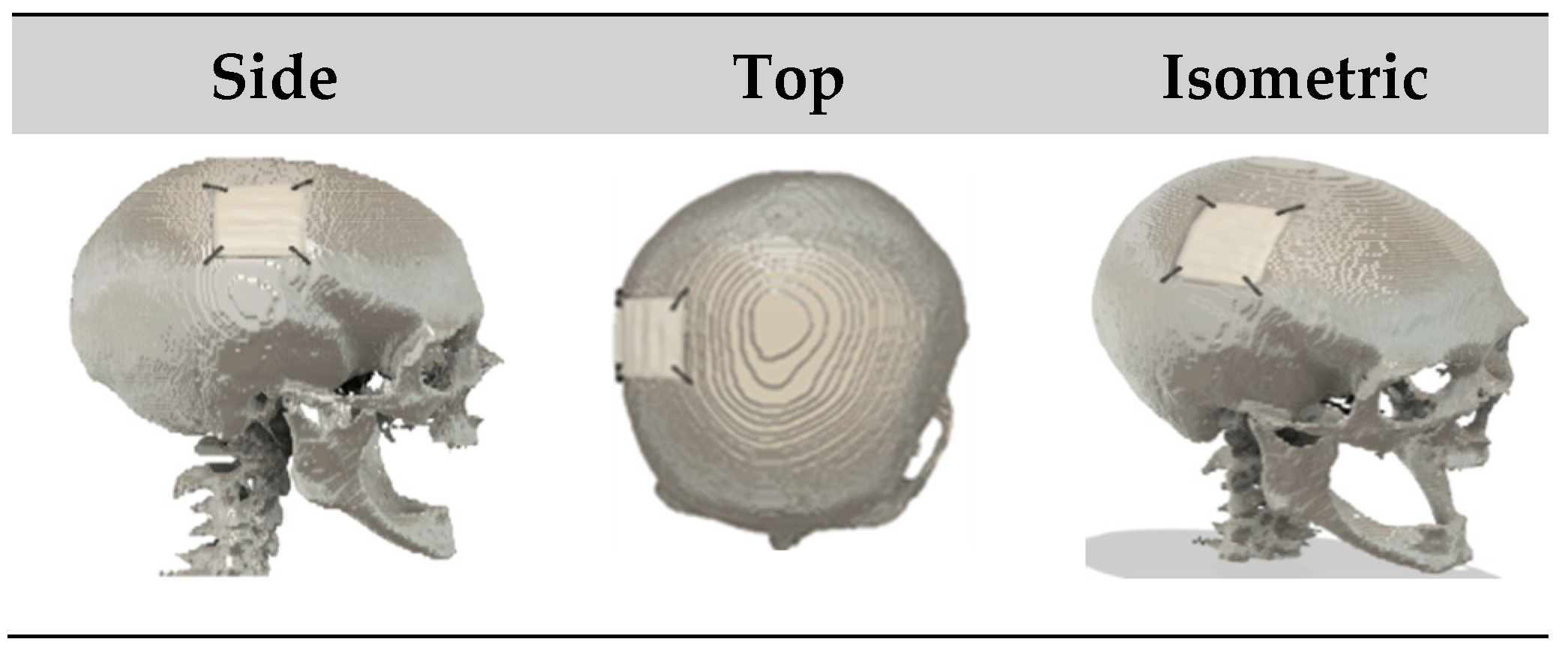 Bioengineering 12 00188 g009