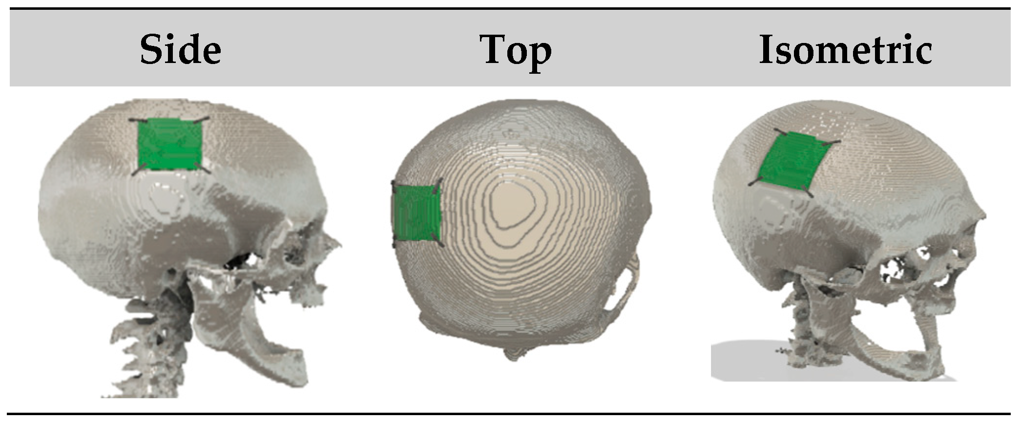 Bioengineering 12 00188 g010