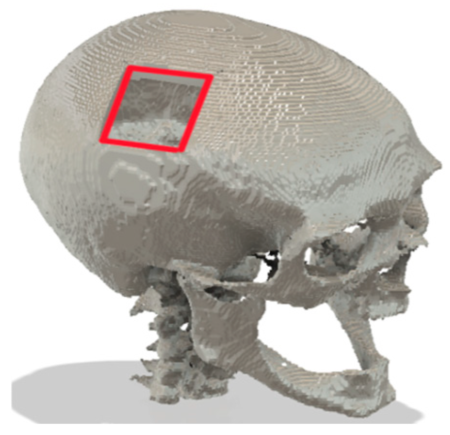Bioengineering 12 00188 g011