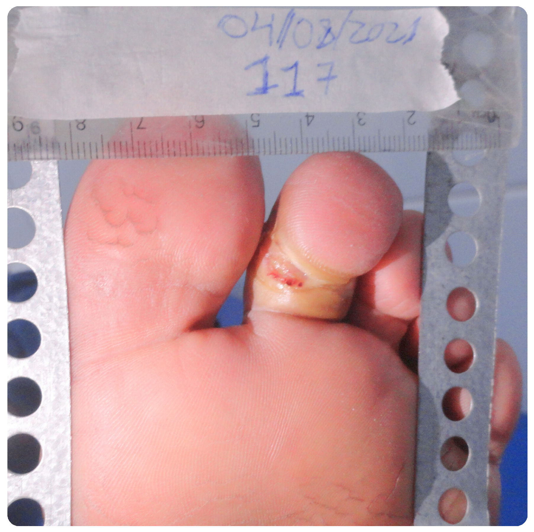 Bioengineering 12 00206 g006 Bioengineering 12 00206 g006