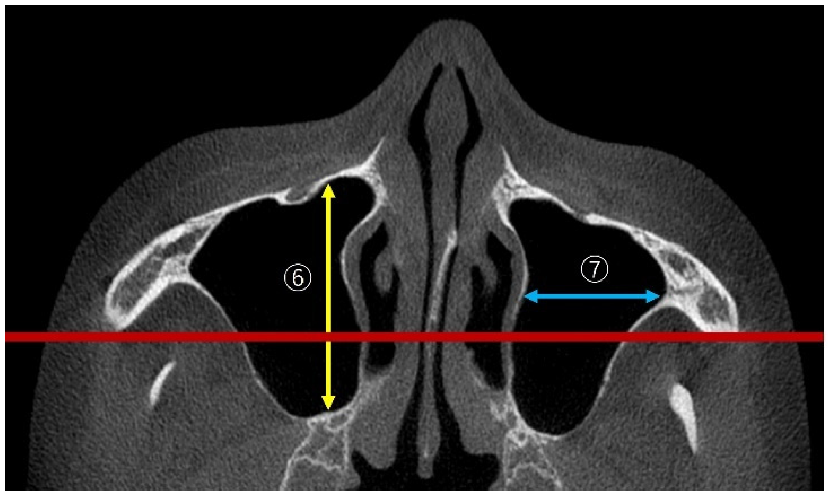Bioengineering 12 00240 g004