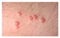 Bioengineering 12 00275 i002