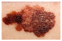 Bioengineering 12 00275 i003