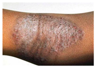 Bioengineering 12 00275 i004