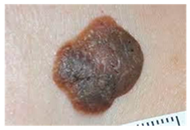 Bioengineering 12 00275 i007