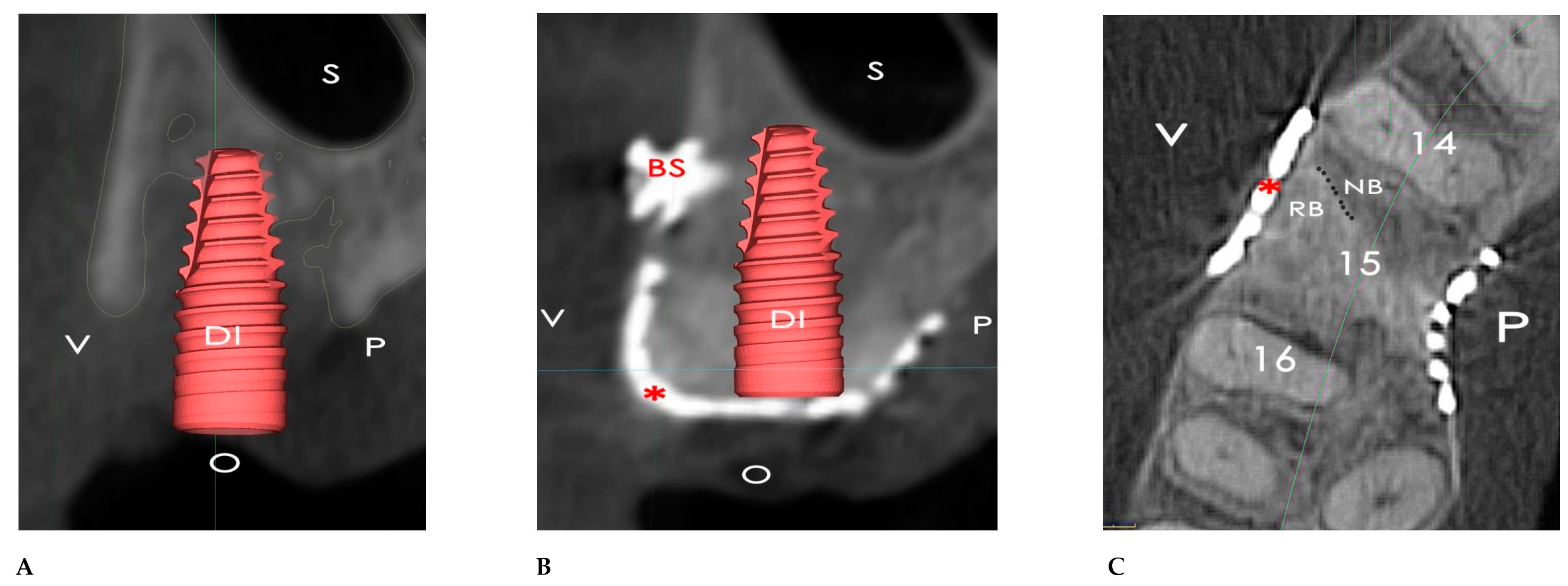 Bioengineering 12 00436 g017